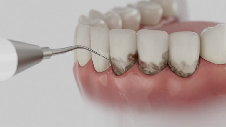 Reliable Dental Implants contractor in Springhill, LA by Smile Center Dentistry